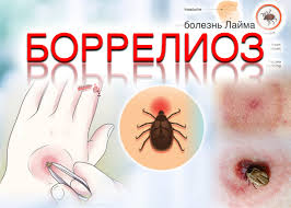Боррелиоз